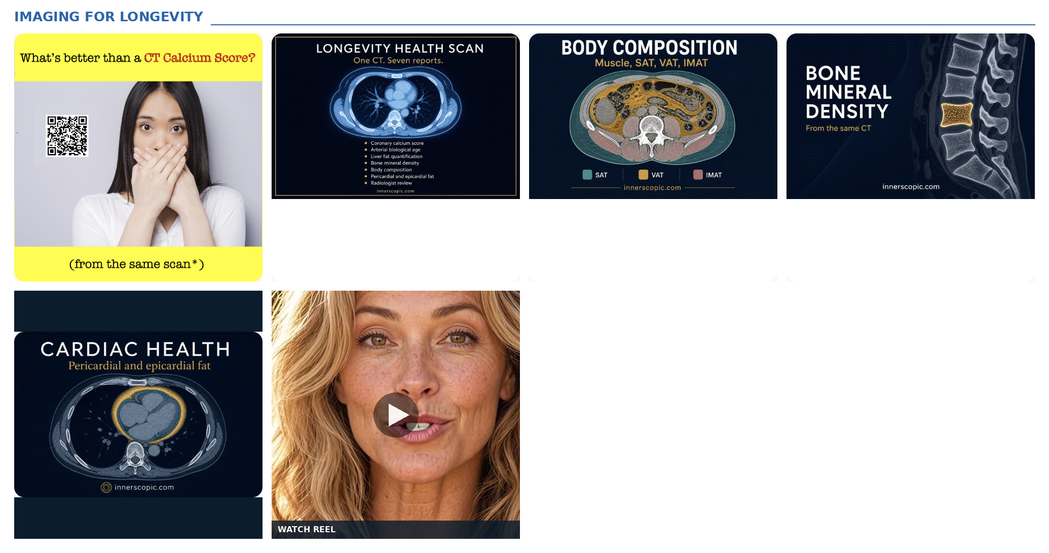 Imaging for Longevity: calcium score hook, Longevity Health Scan, body composition, bone mineral density, cardiac health, and Watch Reel poster